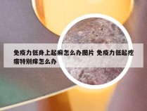 免疫力低身上起癣怎么办图片 免疫力低起疙瘩特别痒怎么办