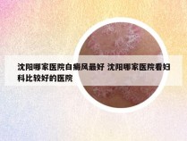 沈阳哪家医院白癜风最好 沈阳哪家医院看妇科比较好的医院