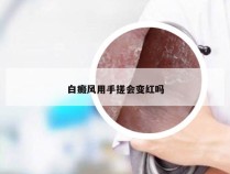 白癜风用手搓会变红吗