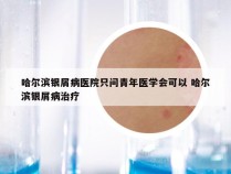 哈尔滨银屑病医院只问青年医学会可以 哈尔滨银屑病治疗