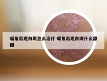 嘴角出现白斑怎么治疗 嘴角出现白斑什么原因