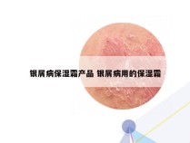 银屑病保湿霜产品 银屑病用的保湿霜