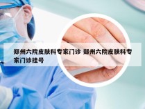 郑州六院皮肤科专家门诊 郑州六院皮肤科专家门诊挂号