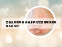 总香豆素银屑病 香豆素的药理作用临床应用及不良反应