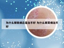 为什么银销病总是治不好 为什么银霄病治不好