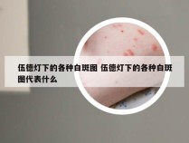 伍德灯下的各种白斑图 伍德灯下的各种白斑图代表什么