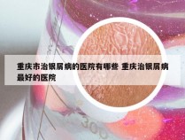 重庆市治银屑病的医院有哪些 重庆治银屑病最好的医院