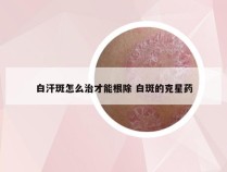 白汗斑怎么治才能根除 白斑的克星药