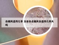 白癜风遗传几率 父亲白点癫风会遗传几率大吗