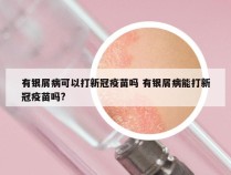 有银屑病可以打新冠疫苗吗 有银屑病能打新冠疫苗吗?