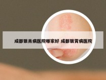 成都银肖病医院哪家好 成都银霄病医院