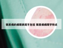 银屑病的病理表现不包括 银屑病病理学特点