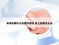 身体出癣什么东西不能吃 身上出癣怎么治