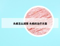 头癣怎么调理 头癣的治疗方案