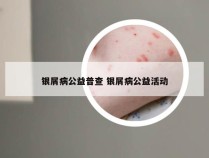 银屑病公益普查 银屑病公益活动