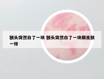 额头突然白了一块 额头突然白了一块跟皮肤一样