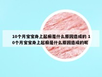 10个月宝宝身上起癣是什么原因造成的 10个月宝宝身上起癣是什么原因造成的呢