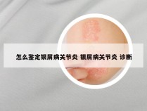 怎么鉴定银屑病关节炎 银屑病关节炎 诊断