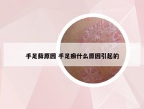 手足藓原因 手足癣什么原因引起的