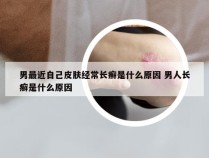 男最近自己皮肤经常长癣是什么原因 男人长癣是什么原因