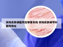 安阳皮肤病医院在哪里安阳 安阳皮肤病专科医院地址