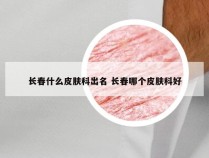 长春什么皮肤科出名 长春哪个皮肤科好