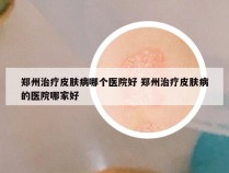 郑州治疗皮肤病哪个医院好 郑州治疗皮肤病的医院哪家好