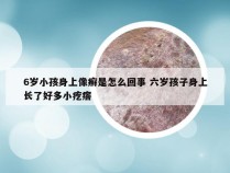 6岁小孩身上像癣是怎么回事 六岁孩子身上长了好多小疙瘩