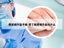 银屑病不能干嘛 得了银屑病不能吃什么