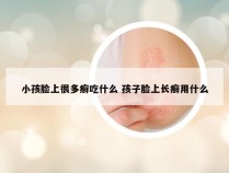 小孩脸上很多癣吃什么 孩子脸上长癣用什么