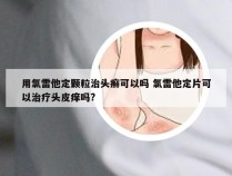 用氯雷他定颗粒治头癣可以吗 氯雷他定片可以治疗头皮痒吗?