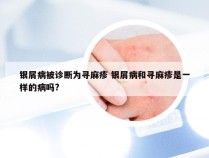 银屑病被诊断为寻麻疹 银屑病和寻麻疹是一样的病吗?