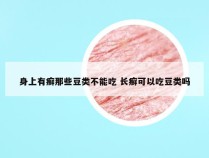 身上有癣那些豆类不能吃 长癣可以吃豆类吗