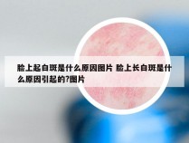 脸上起白斑是什么原因图片 脸上长白斑是什么原因引起的?图片