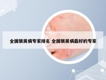 全国银屑病专家排名 全国银屑病最好的专家