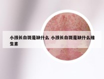 小孩长白斑是缺什么 小孩长白斑是缺什么维生素