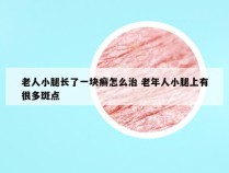 老人小腿长了一块癣怎么治 老年人小腿上有很多斑点