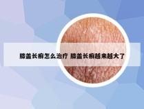 膝盖长癣怎么治疗 膝盖长癣越来越大了