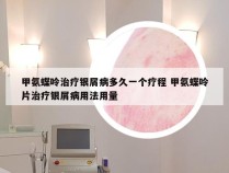 甲氨蝶呤治疗银屑病多久一个疗程 甲氨蝶呤片治疗银屑病用法用量