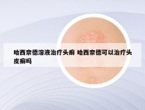 哈西奈德溶液治疗头癣 哈西奈德可以治疗头皮癣吗