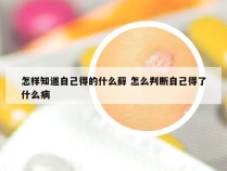 怎样知道自己得的什么藓 怎么判断自己得了什么病