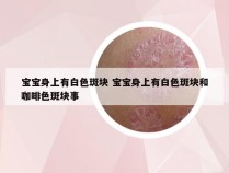 宝宝身上有白色斑块 宝宝身上有白色斑块和咖啡色斑块事