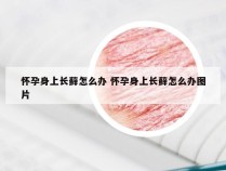 怀孕身上长藓怎么办 怀孕身上长藓怎么办图片