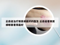 云南省治疗银屑病最好的医生 云南省看银屑病哪里看得最好