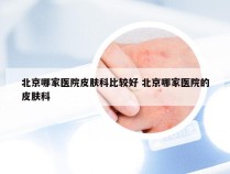 北京哪家医院皮肤科比较好 北京哪家医院的皮肤科