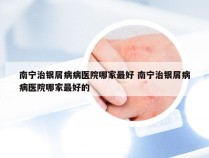 南宁治银屑病病医院哪家最好 南宁治银屑病病医院哪家最好的