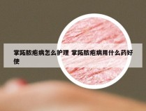 掌跖脓疱病怎么护理 掌跖脓疱病用什么药好使