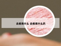 去癣用什么 去癣用什么药