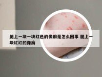 腿上一块一块红色的像癣是怎么回事 腿上一块红红的像癣