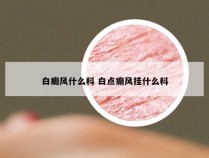 白癜风什么科 白点癫风挂什么科